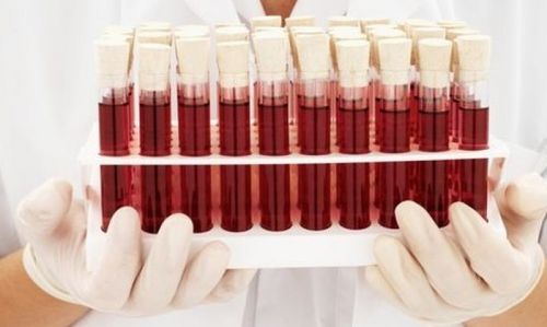 Вчені встановили найбільш небезпечну для життя групу крові