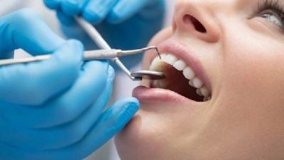 Стоматологи назвали продукты для здоровья зубов